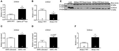 S100A4 as a Target of the E3-Ligase Asb2β and Its Effect on Engineered Heart Tissue